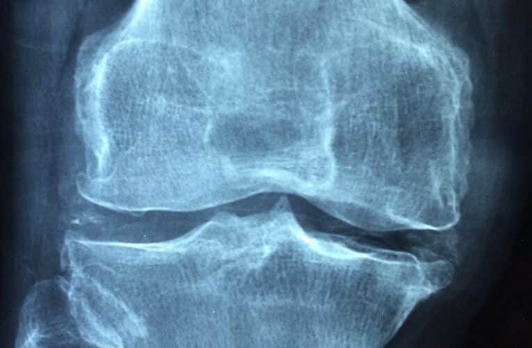 Jakie schorzenia leczy ortopeda i jak można skorzystać z ich usług?